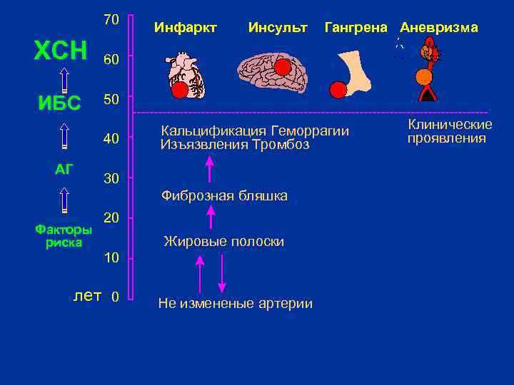 70 ХСН ИБС Инсульт 50 Кальцификация Геморрагии Изъязвления Тромбоз 30 Фиброзная бляшка Факторы риска