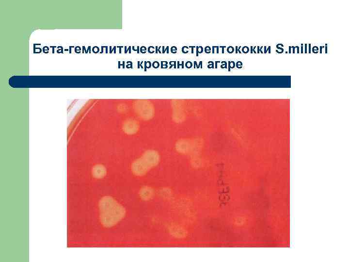 Бета-гемолитические стрептококки S. milleri на кровяном агаре 