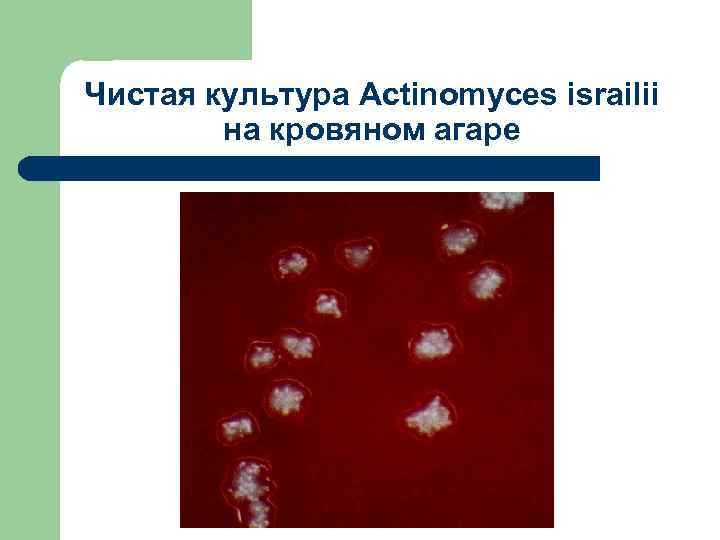 Чистая культура Actinomyces israilii на кровяном агаре 