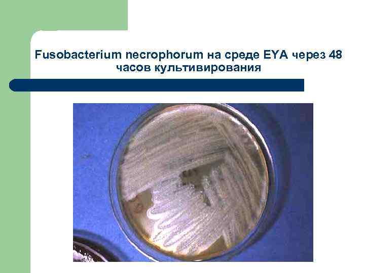 Fusobacterium necrophorum на среде EYA через 48 часов культивирования 