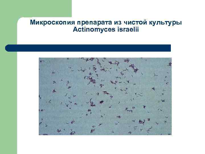 Микроскопия препарата из чистой культуры Аctinomyces israelii 