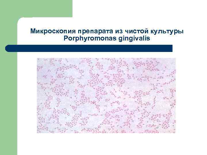 Микроскопия препарата из чистой культуры Porphyromonas gingivalis 