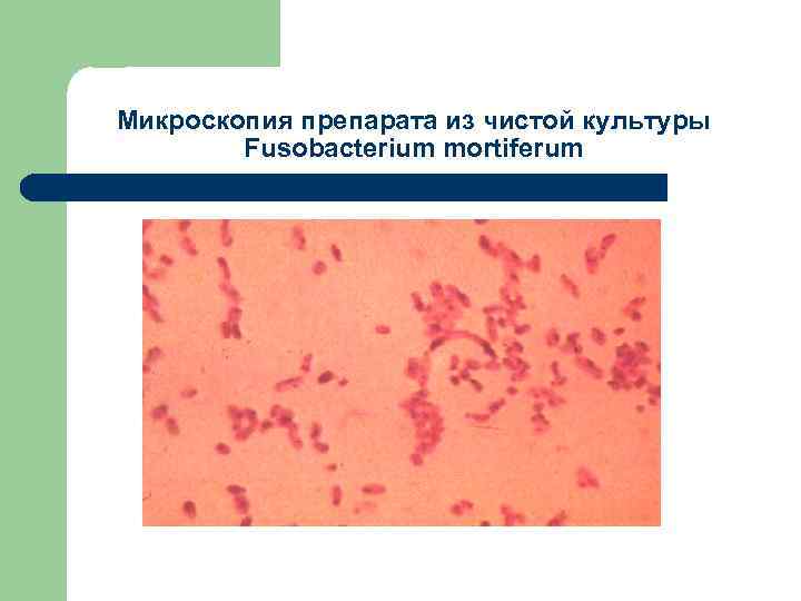 Микроскопия препарата из чистой культуры Fusobacterium mortiferum 