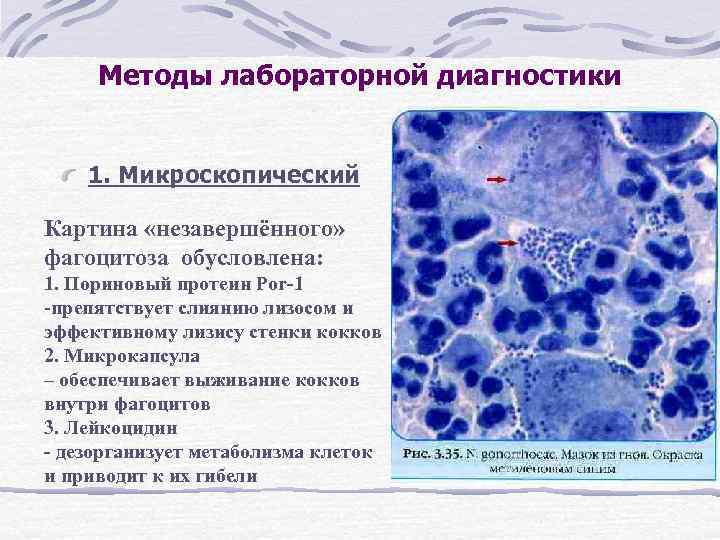 Методы лабораторной диагностики 1. Микроскопический Картина «незавершённого» фагоцитоза обусловлена: 1. Пориновый протеин Por-1 -препятствует