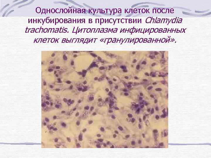 Однослойная культура клеток после инкубирования в присутствии Chlamydia trachomatis. Цитоплазма инфицированных клеток выглядит «гранулированной»