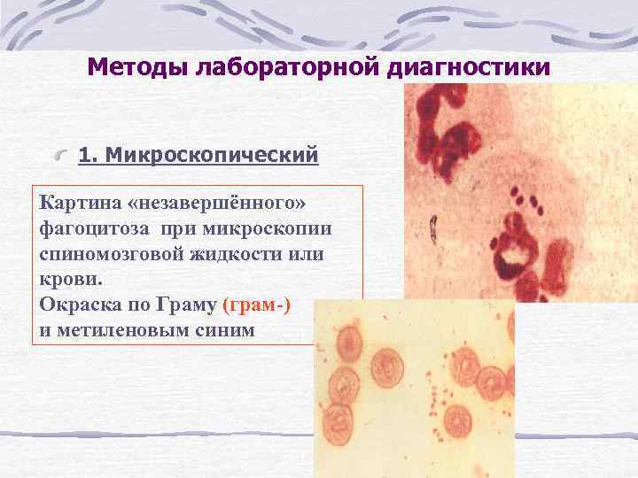 Методы лабораторной диагностики 1. Микроскопический Картина «незавершённого» фагоцитоза при микроскопии спиномозговой жидкости или крови.