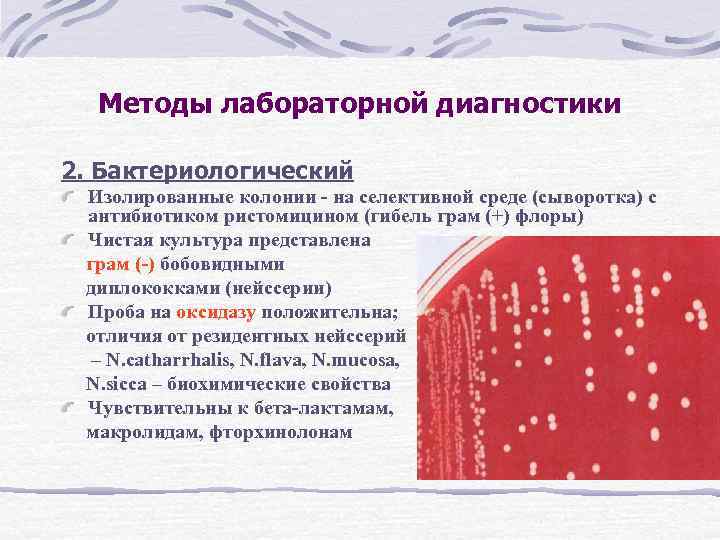 Методы лабораторной диагностики 2. Бактериологический Изолированные колонии - на селективной среде (сыворотка) с антибиотиком