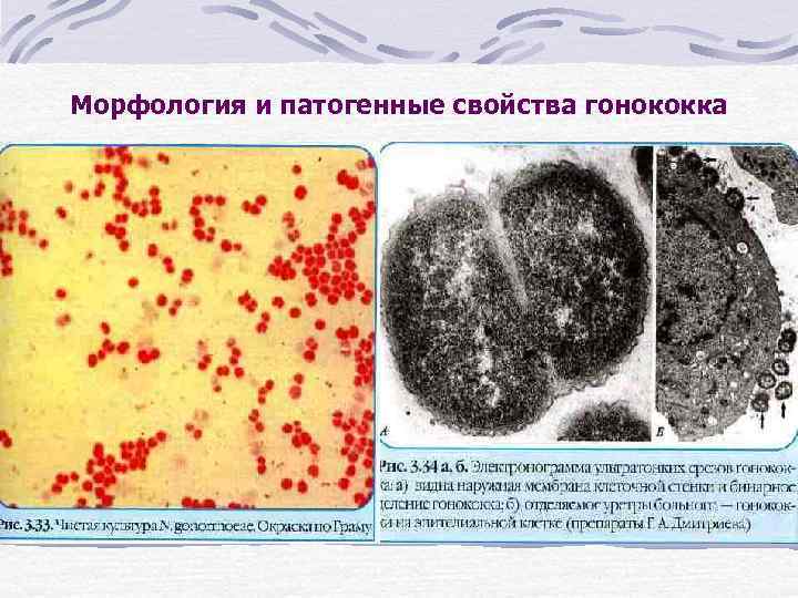 Морфология и патогенные свойства гонококка 