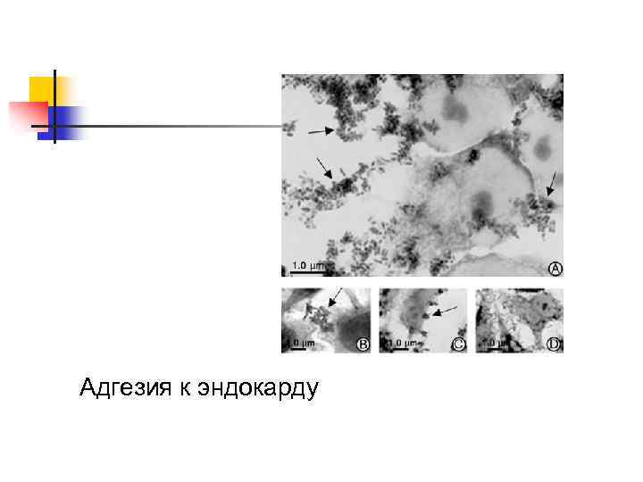 Адгезия к эндокарду 