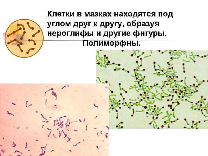 Полиморфная палочка в мазке. Бациллы в мазке располагаются. Мазок ложнодифтерийная палочка. Мазок ложнодифтерийной палочки по Ожешко.