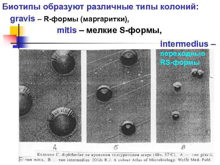 Типы колоний. Характеристика s и r форм колоний. Формы колоний микробиология r s. Формы колоний микроорганизмов SR. R И S формы колоний бактерий.