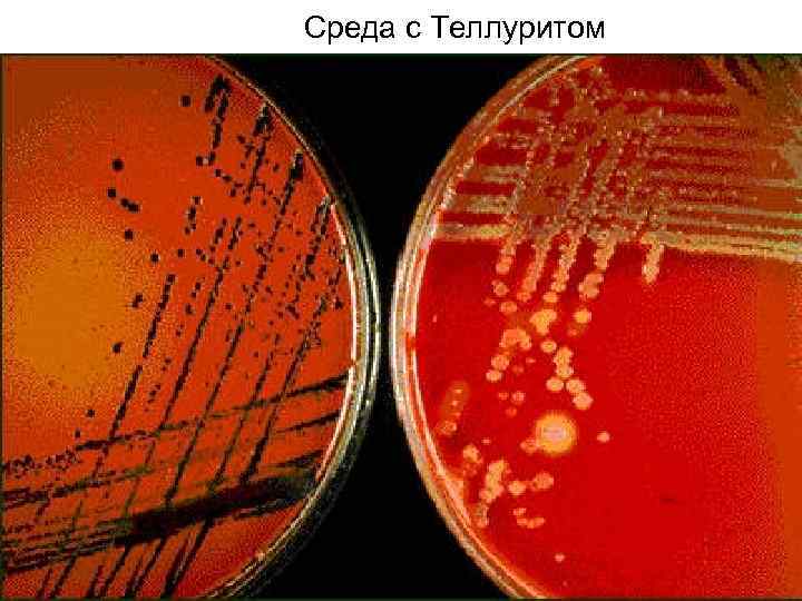 Среда с Теллуритом 