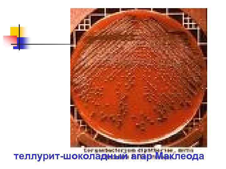теллурит-шоколадный агар Маклеода 