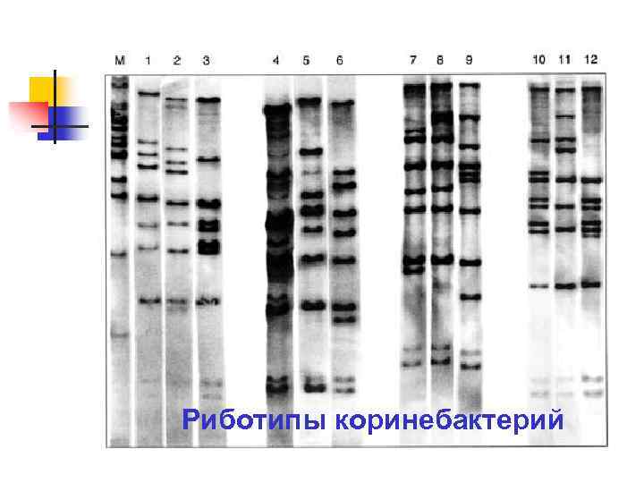 Риботипы коринебактерий 