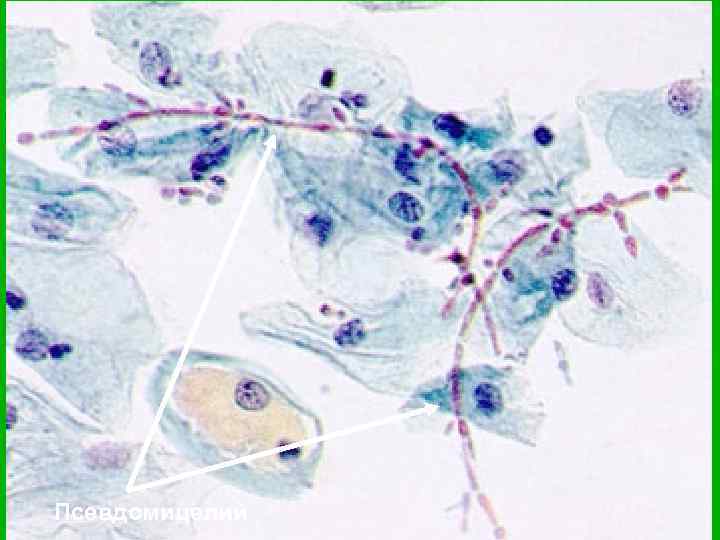 Псевдомицелий 