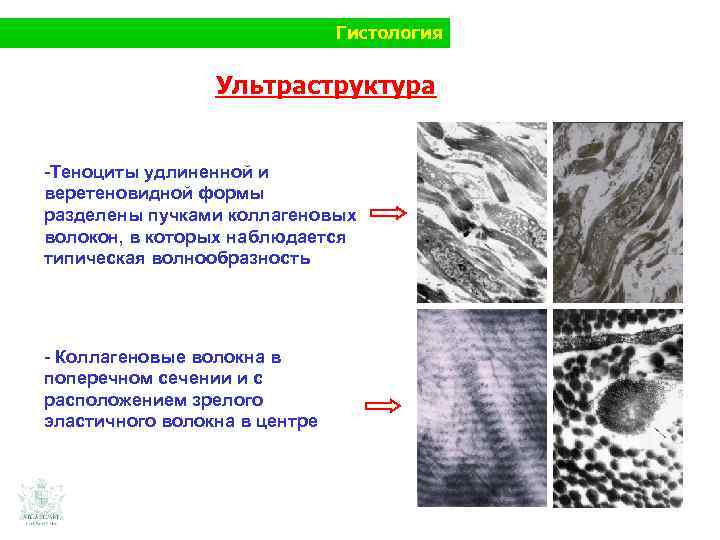 Гистология Ультраструктура -Теноциты удлиненной и веретеновидной формы разделены пучками коллагеновых волокон, в которых наблюдается