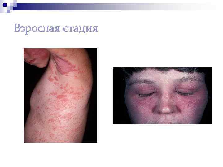 Взрослая стадия 