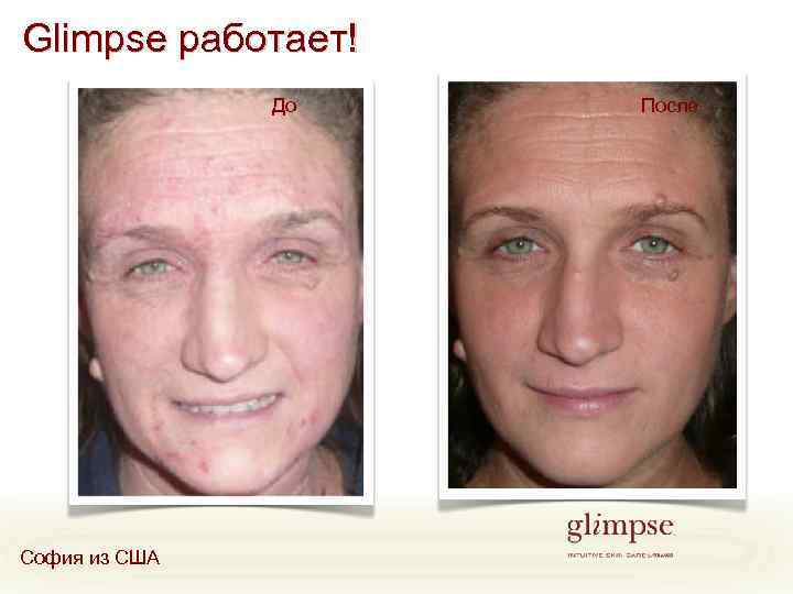 Glimpse работает! До София из США После 