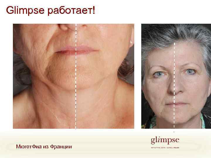 Glimpse работает! Мюгет. Фиа из Франции 