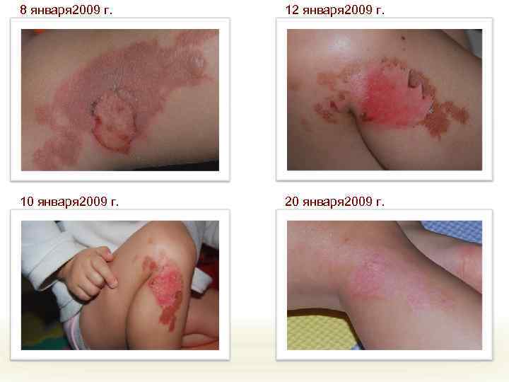 8 января 2009 г. 12 января 2009 г. 10 января 2009 г. 20 января