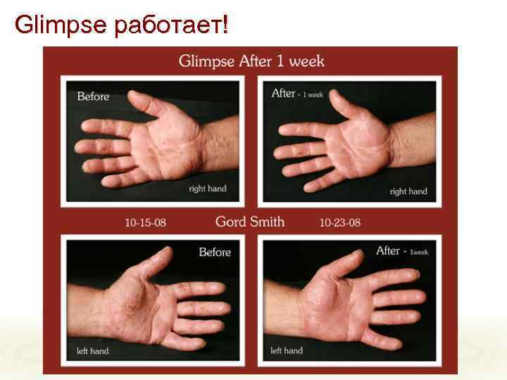 Glimpse работает! 