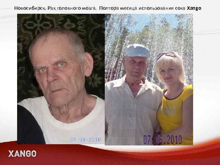 Новосибирск. Рак головного мозга. Полтора месяца использования сока Xango 