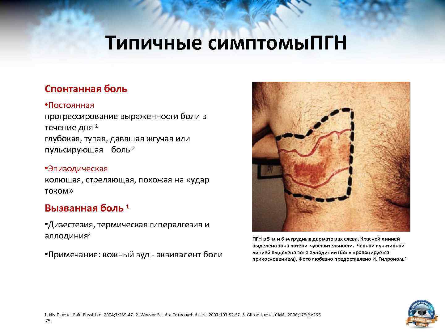Типичные симптомы. ПГН Спонтанная боль • Постоянная прогрессирование выраженности боли в течение дня 2