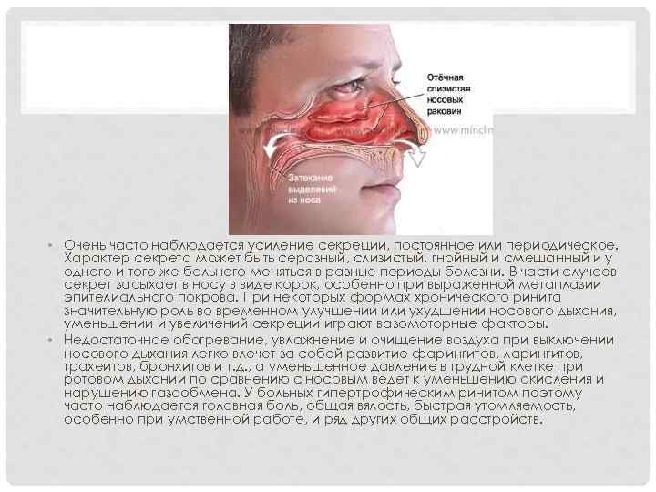  • Очень часто наблюдается усиление секреции, постоянное или периодическое. Характер секрета может быть