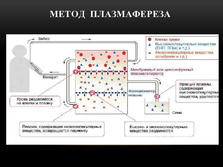 МЕТОД ПЛАЗМАФЕРЕЗА 