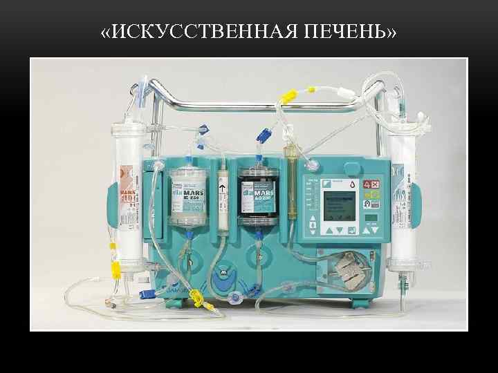  «ИСКУССТВЕННАЯ ПЕЧЕНЬ» 