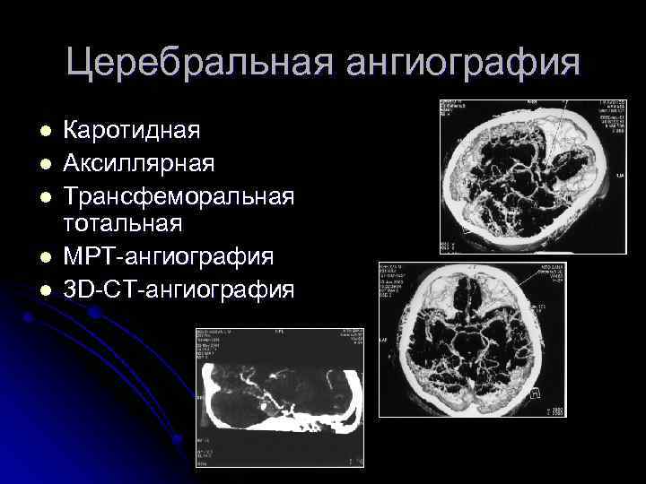 Церебральная ангиография l l l Каротидная Аксиллярная Трансфеморальная тотальная МРТ-ангиография 3 D-CT-ангиография 