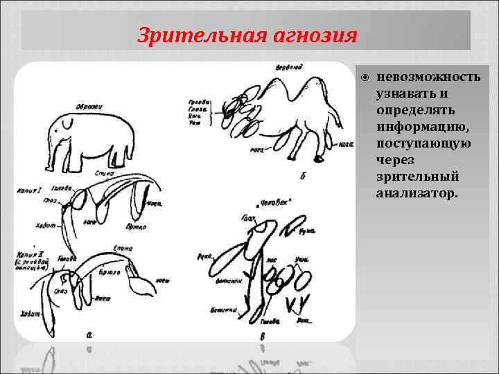 Зрительная агнозия невозможность узнавать и определять информацию, поступающую через зрительный анализатор. 