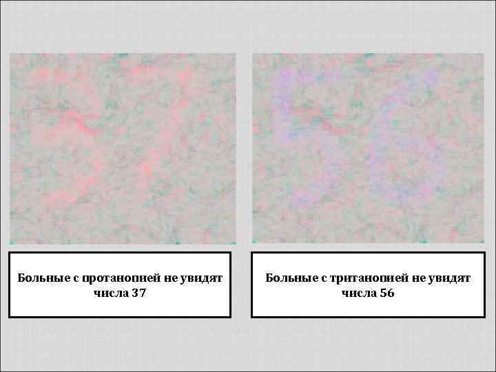 Больные с протанопией не увидят числа 37 Больные с тританопией не увидят числа 56