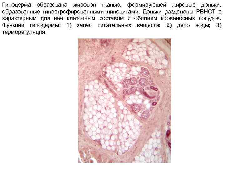 Гиподерма образована. Гиподерма гистология препарат. Жировая ткань кожи пальца гистология препарат. Гиподерма кожи гистология.