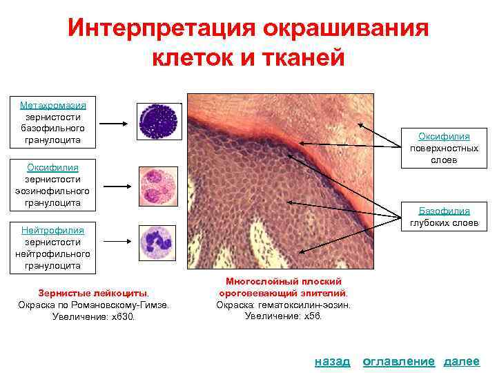 Интерпретация окрашивания клеток и тканей Метахромазия зернистости базофильного гранулоцита Оксифилия поверхностных слоев Оксифилия зернистости