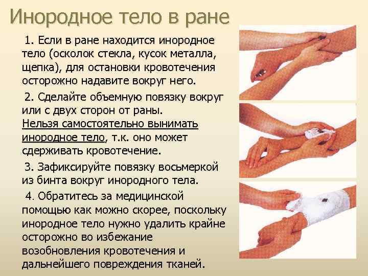 Инородное тело в ране 1. Если в ране находится инородное тело (осколок стекла, кусок