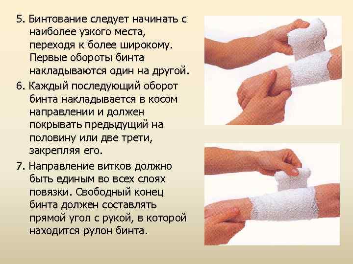 5. Бинтование следует начинать с наиболее узкого места, переходя к более широкому. Первые обороты