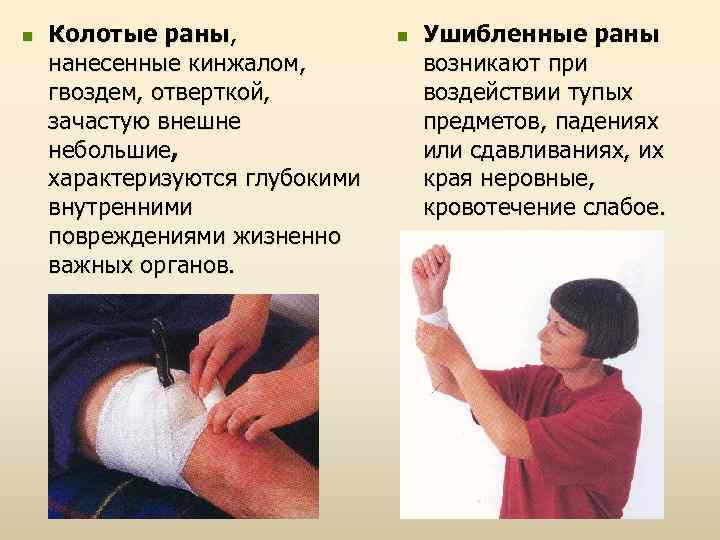 n Колотые раны, нанесенные кинжалом, гвоздем, отверткой, зачастую внешне небольшие, характеризуются глубокими внутренними повреждениями