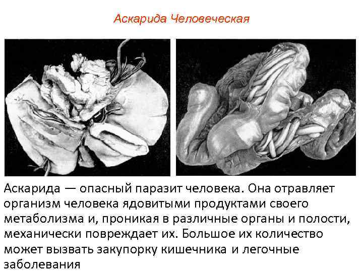 Аскарида Человеческая Аскарида — опасный паразит человека. Она отравляет организм человека ядовитыми продуктами своего