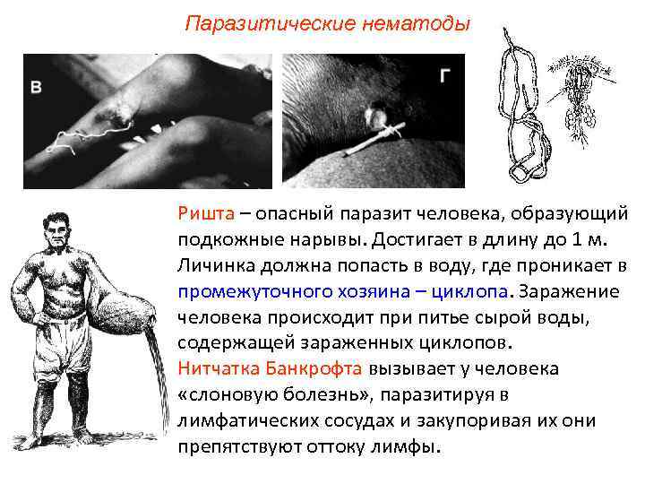 Паразитические нематоды Ришта – опасный паразит человека, образующий подкожные нарывы. Достигает в длину до