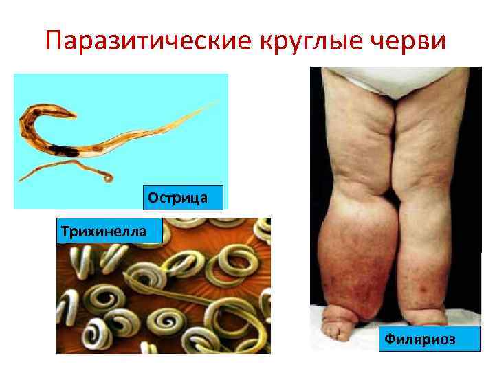 Паразитические круглые черви Острица Трихинелла Филяриоз 