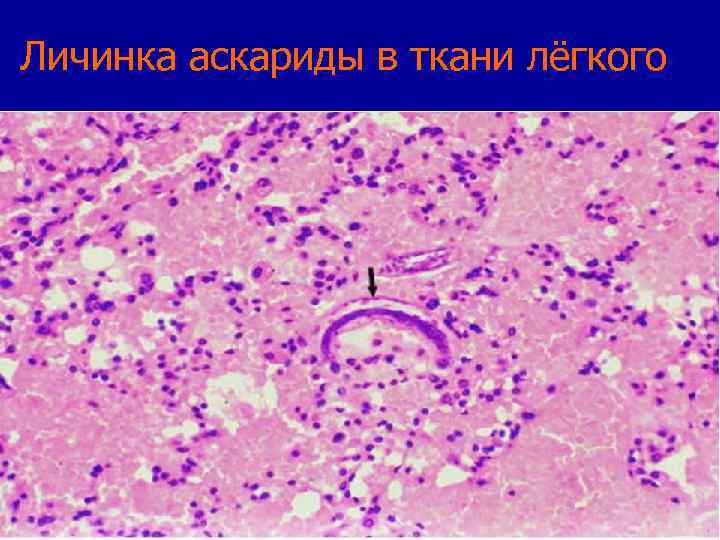 Какой цифрой обозначена на рисунке личинка аскариды в теле человека