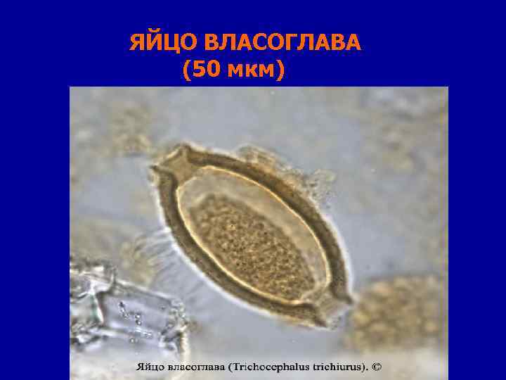 ЯЙЦО ВЛАСОГЛАВА (50 мкм) 