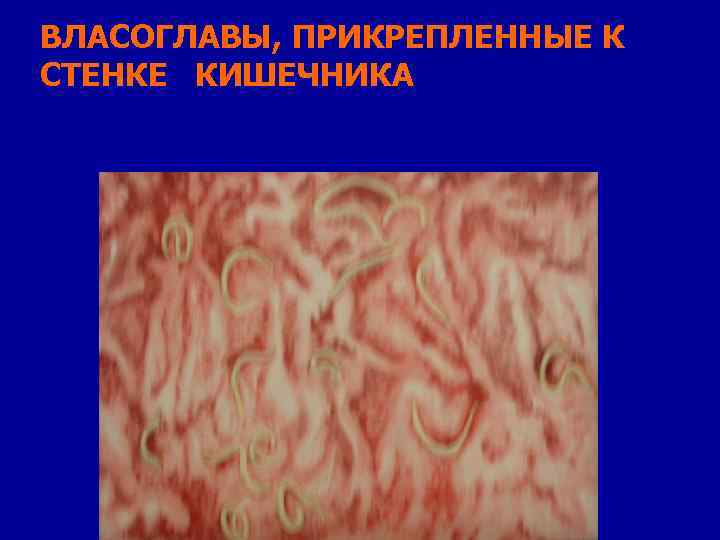 ВЛАСОГЛАВЫ, ПРИКРЕПЛЕННЫЕ К СТЕНКЕ КИШЕЧНИКА 