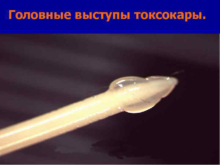 Головные выступы токсокары. 