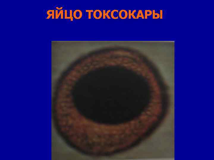 ЯЙЦО ТОКСОКАРЫ 