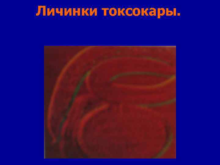 Личинки токсокары. 