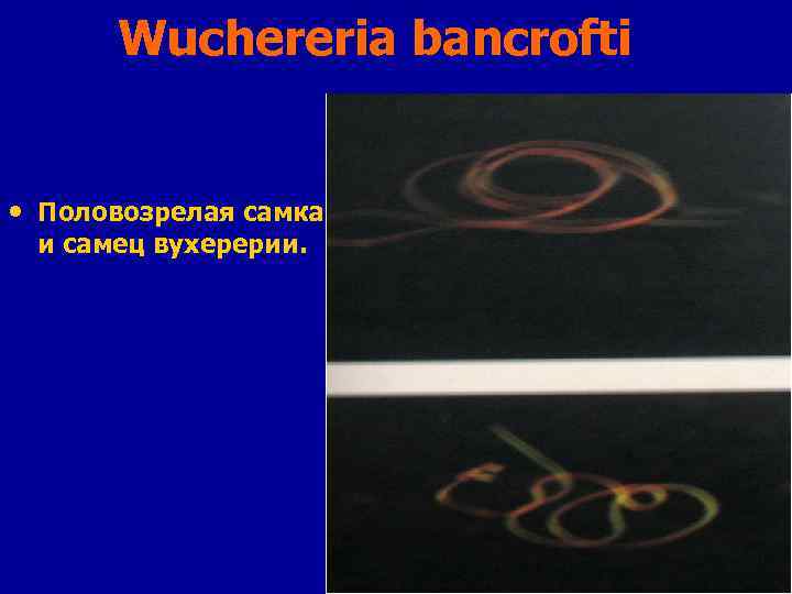 Wuchereria bancrofti • Половозрелая самка и самец вухерерии. 