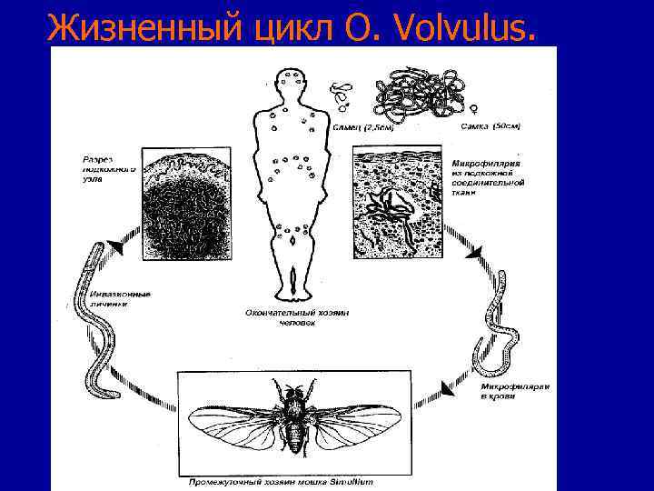 Жизненный цикл O. Volvulus. 