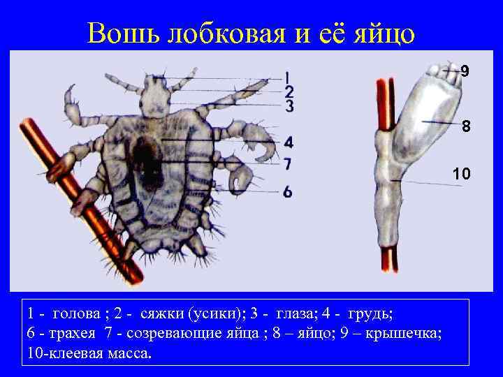 Вошь лобковая и её яйцо 9 8 10 1 - голова ; 2 -